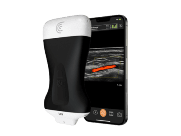 Handheld Ultrasound Systems